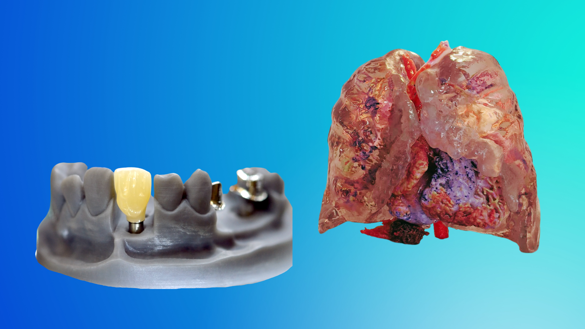 3D printed tooth and 3D printed anatomical model.